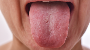 What your tongue says about your internal health, according to a Cornell University longevity doctor