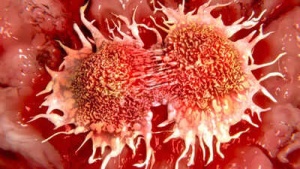 Vitamin C Deficiency Linked to Increased Risk of Stomach, Esophageal, and Lung Cancers: Know the Symptoms