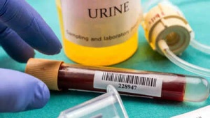 Understanding proteinuria: Kidney warning sign common in men with diabetes and high BP