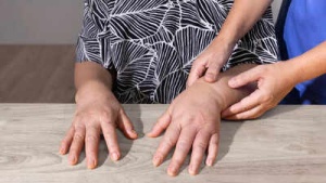 Decoding Swollen Fingers: 8 Common Causes and How to Manage Them