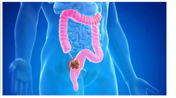 Unexplained weight loss is a warning sign.