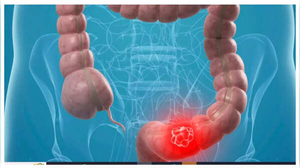 Do not ignore abdominal pain.