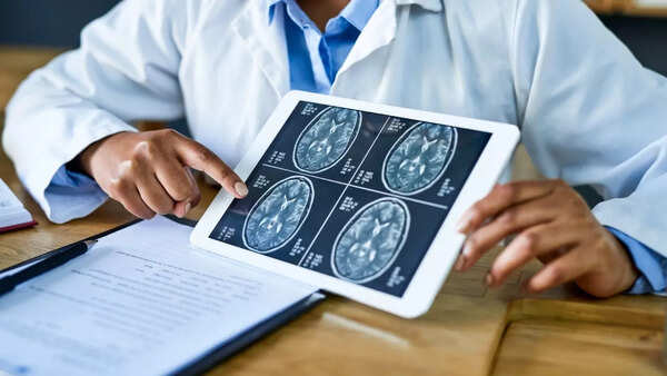 Abstract representation of the brain