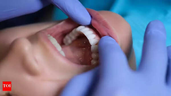 Common signs and symptoms of oral cancer